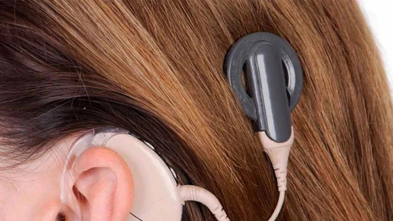 გასულ წელს სამინისტრომ ₾3 მლნ-ზე მეტი ღირებულების კოხლეარული იმპლანტის აპარატები დააფინანსა